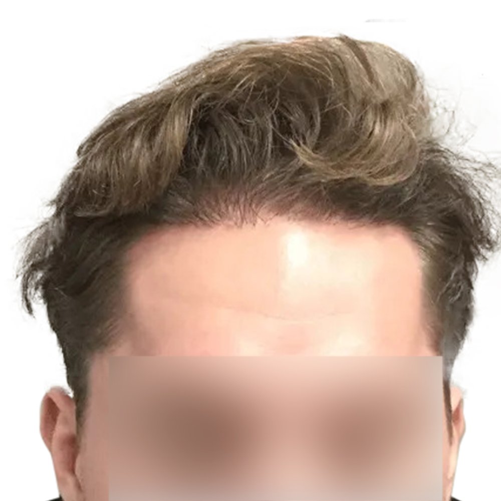 DY-BA-Image-132+(1)-1920w.png_2.jpg