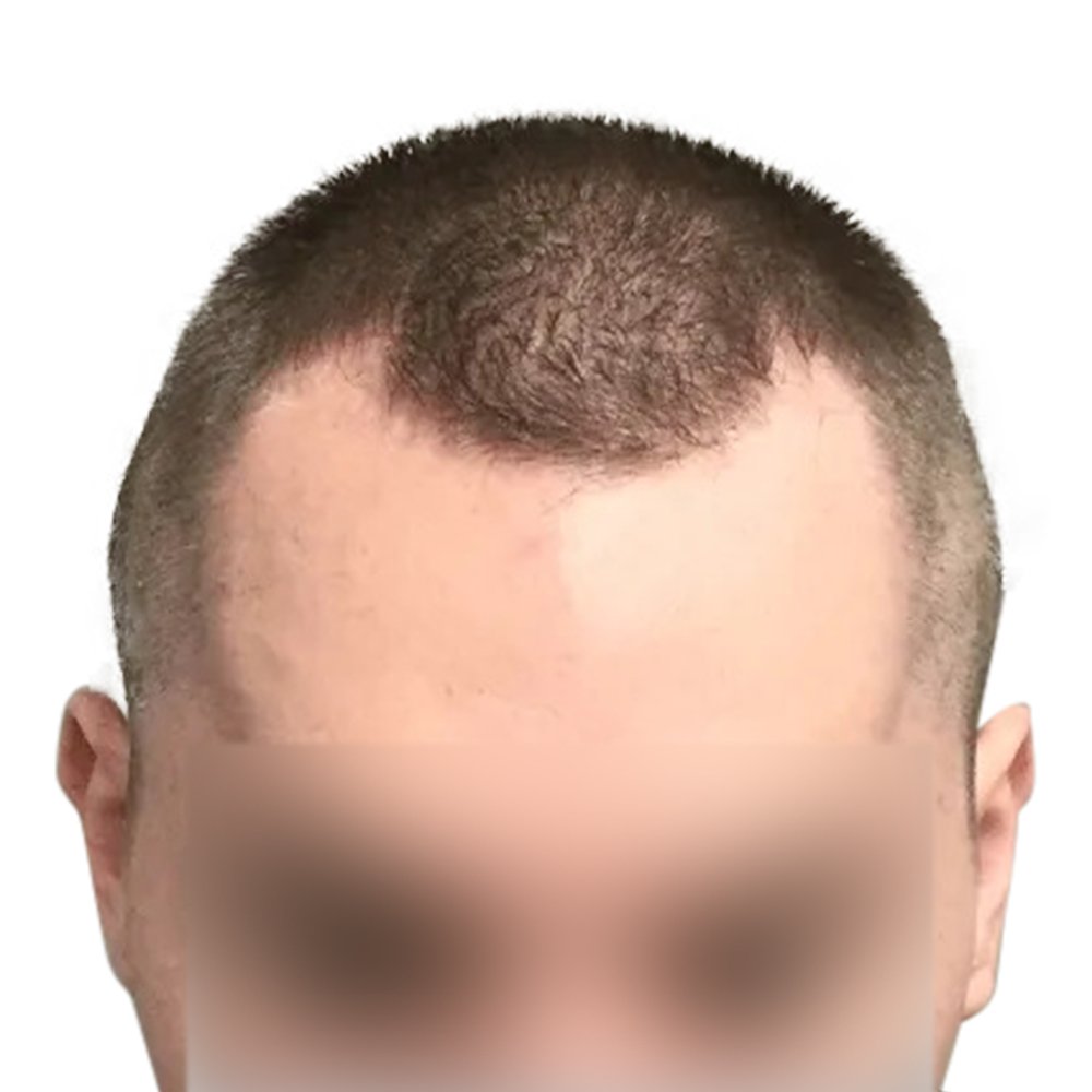 DY-BA-Image-132+(1)-1920w.png.jpg