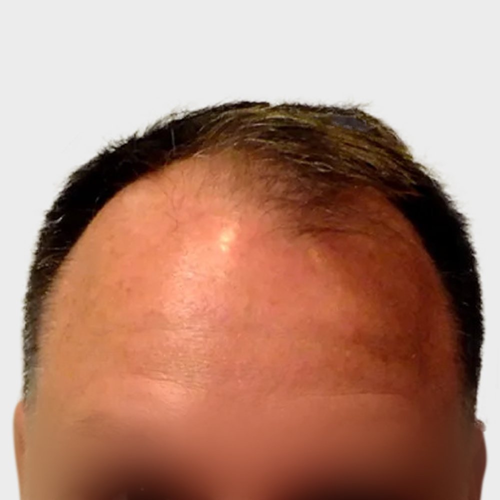 DY-BA-Image-49-1920w.png.jpg