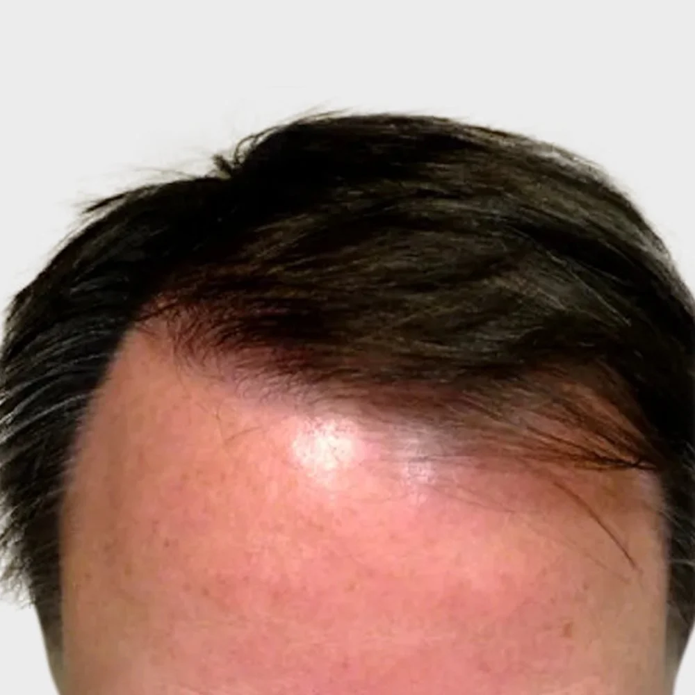 DY-BA-Image-49-1920w.png_2.jpg