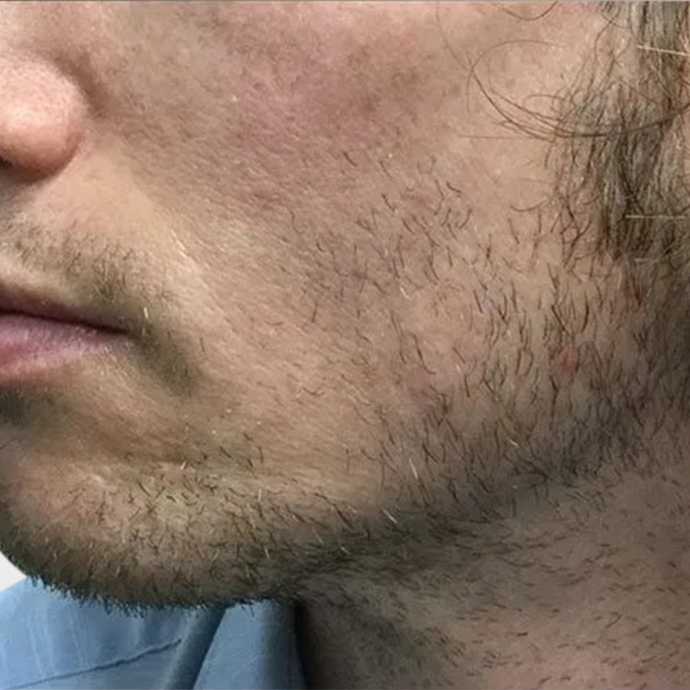 beard1 BEFORE-1920w.jpeg.jpg