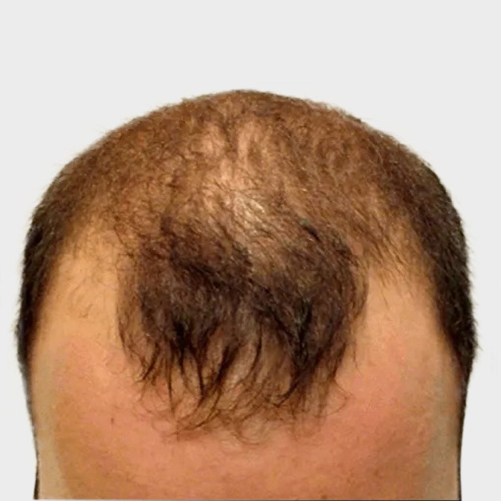 DY-BA-Image-14-1920w.png.jpg