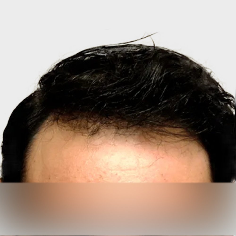 DY-BA-Image-41-1920w.png_2.jpg