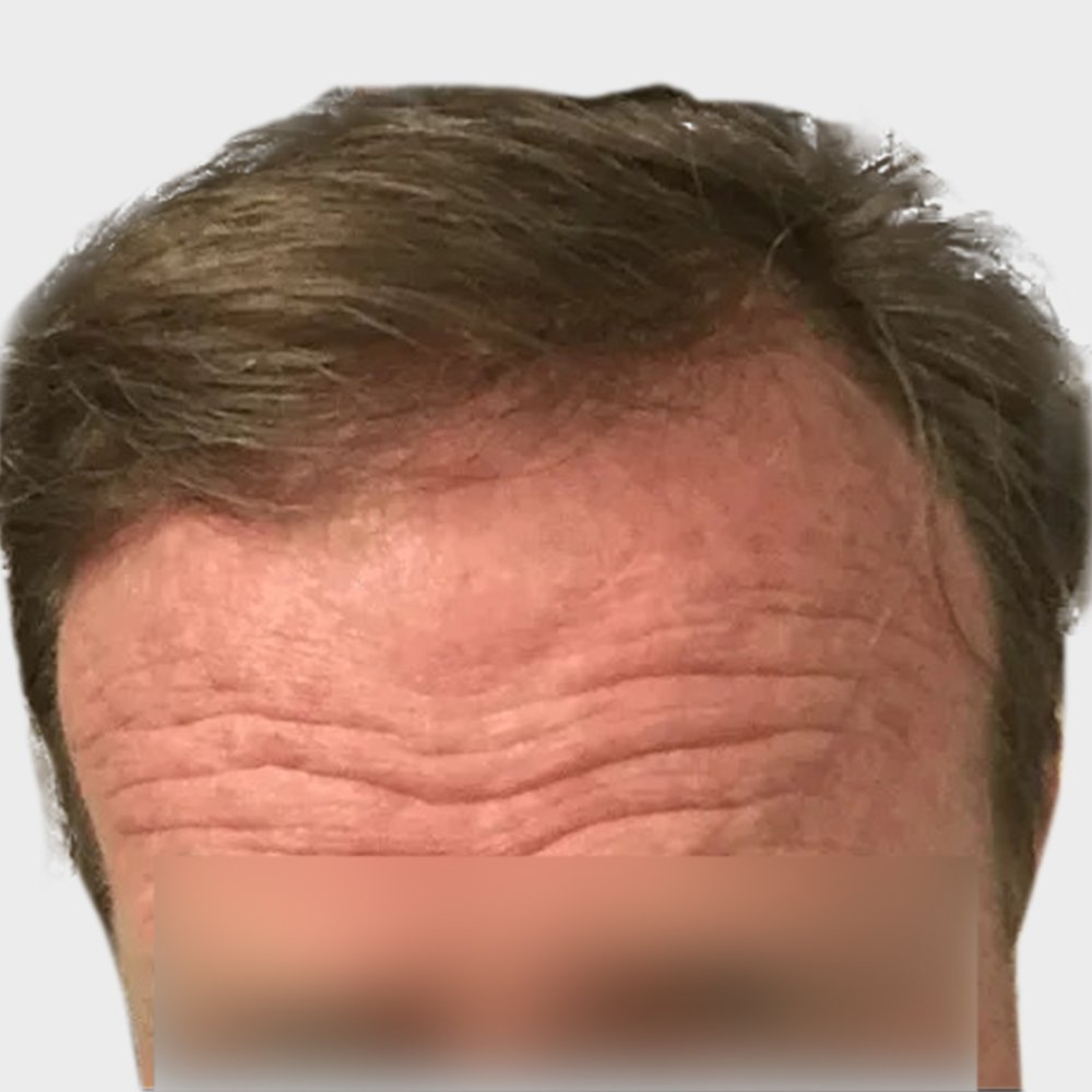 Square Hair 1 After.jpg