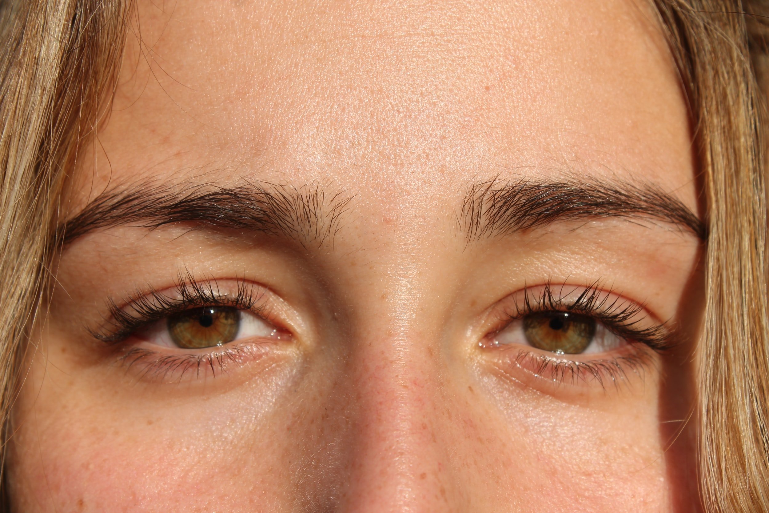 How do you heal dry eyes?, Florida Eye Care Tips, Florida