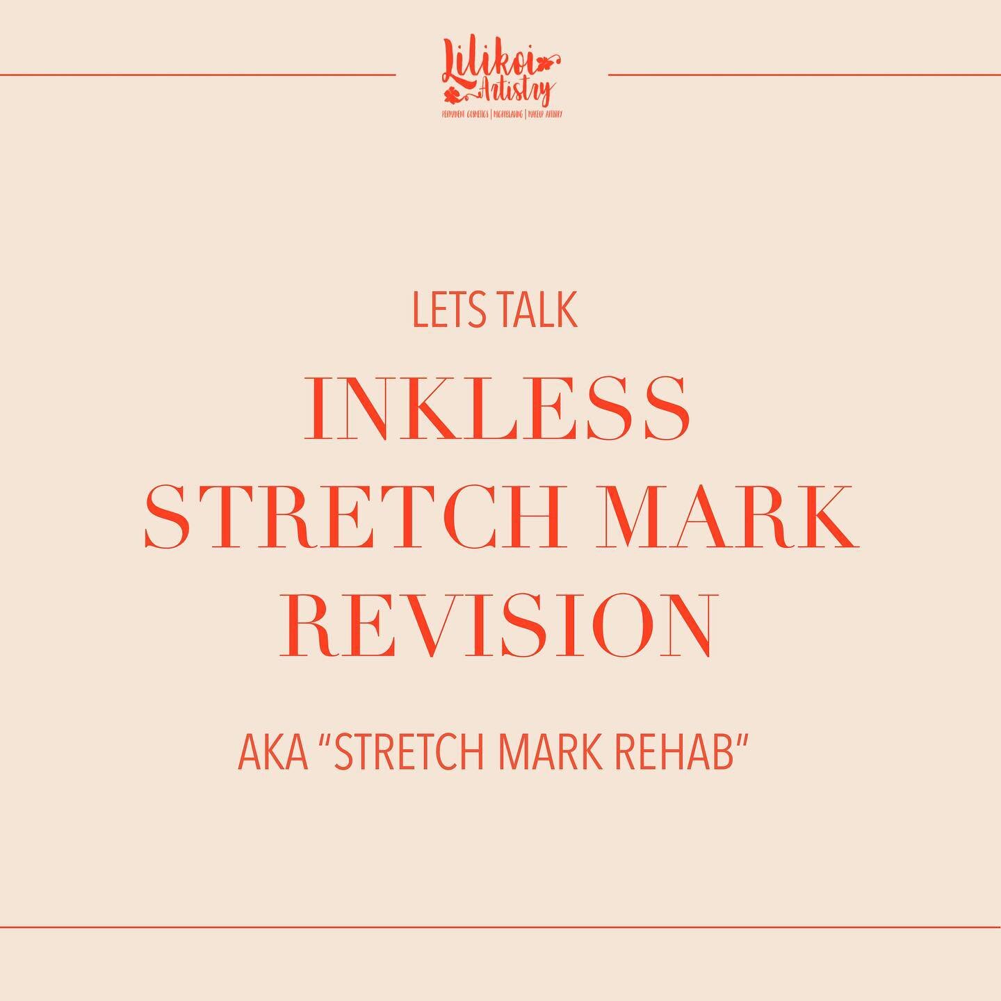INKLESS STRETCHMARK REVISION

New service offered by Lilikoi Artistry!

I&rsquo;m sure you have a ton of questions so let&rsquo;s answer a few!

-What does the procedure involve? 
Angie will use a machine to open the skin in the area you wish to have