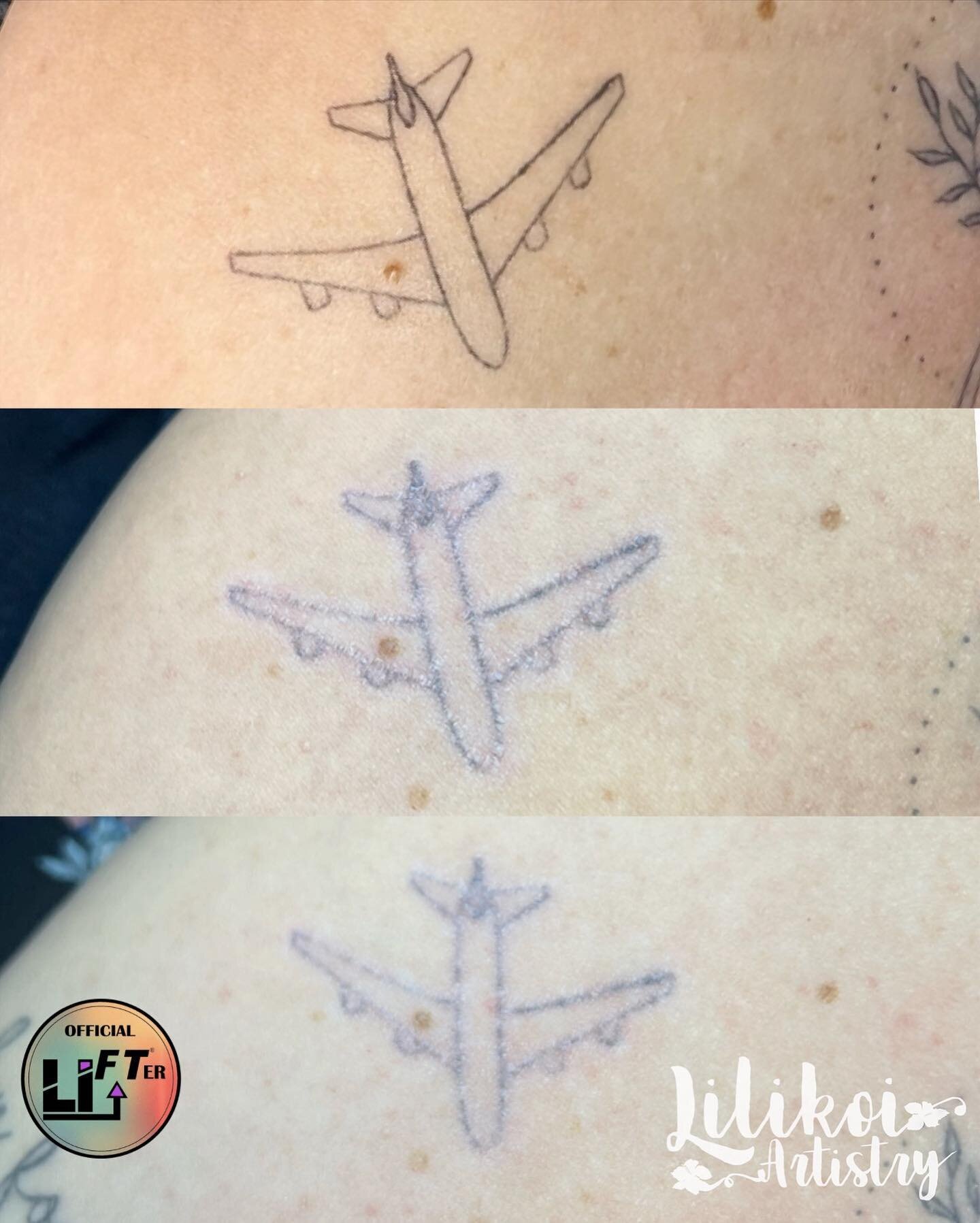 Progress of body art tattoo removal after 2 sessions of @liftinkremoval 

Yes! We can lighten body art tattoos as well!

How many sessions will it take?  That depends on if we&rsquo;re trying to removal all visible color or if we just need to lighten