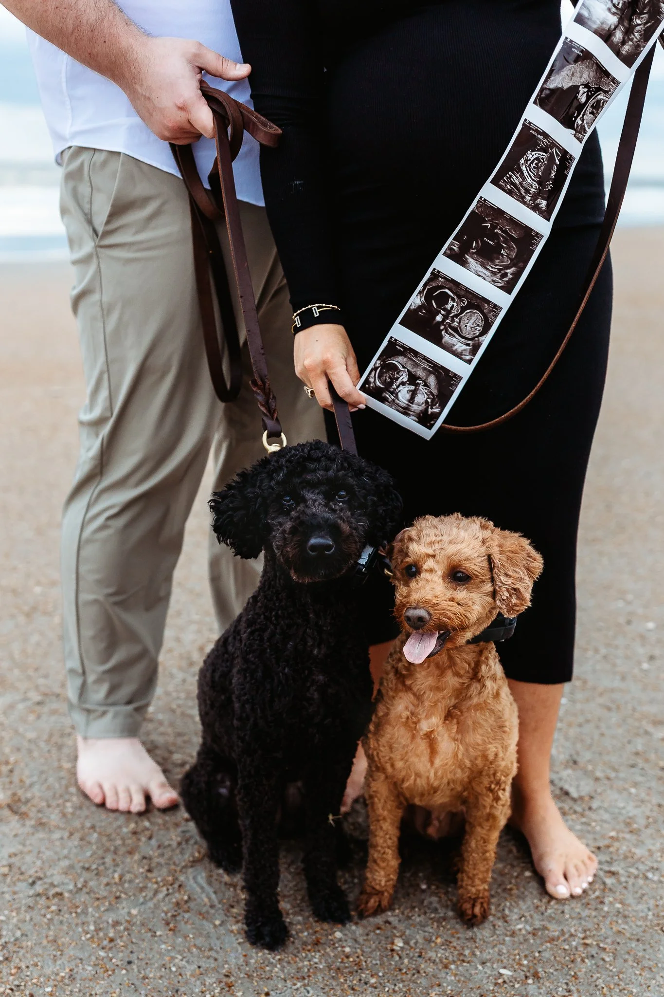 Close view of sonogram photographs held in front of a pregnant mother’s belly and dogs in front of it