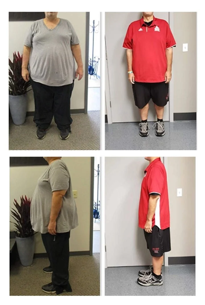 Client: 48 y/o Male Duration : 12 weeks Initial Results: Down 70 lbs After rapid weight loss (health coaching and nutrition session): Down 118.6 lbs Total Weight Loss: 188.3