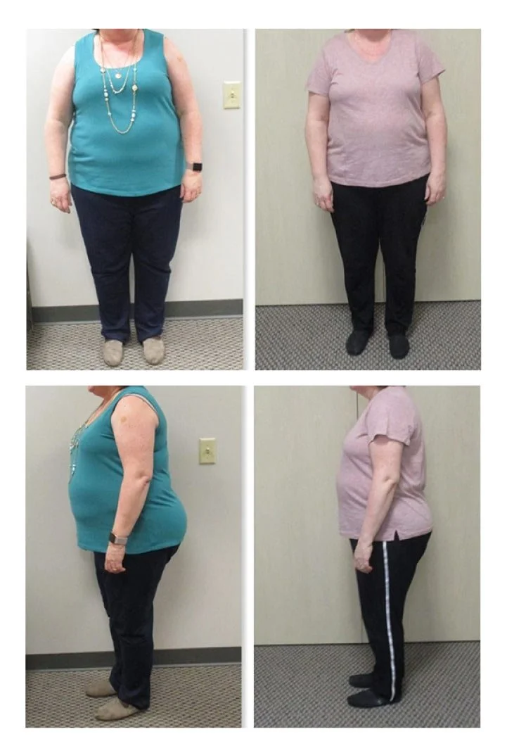 Client: 56 y/o Female Duration: 12 weeks Weight loss: 41.5 lbs