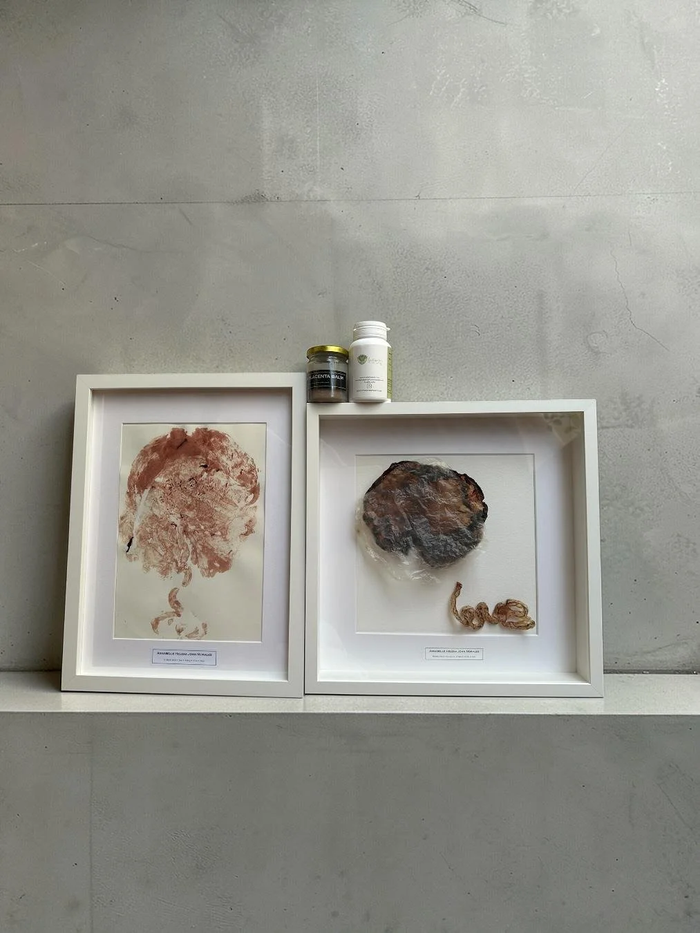 All 3 Add-ons Bundle (Art + Keepsake + Balm)