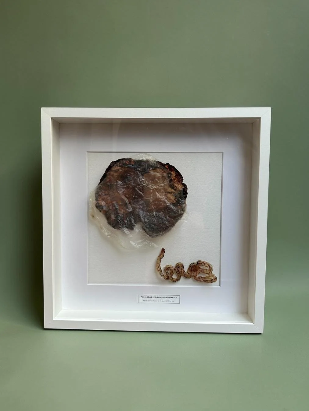 Umbilical Cord &/or Amniotic Sac Framed Keepsake