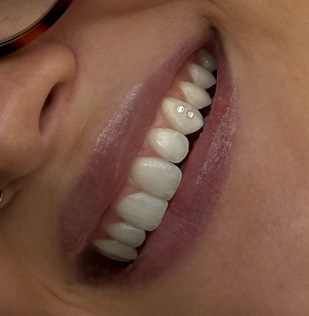 TOOTH GEMS