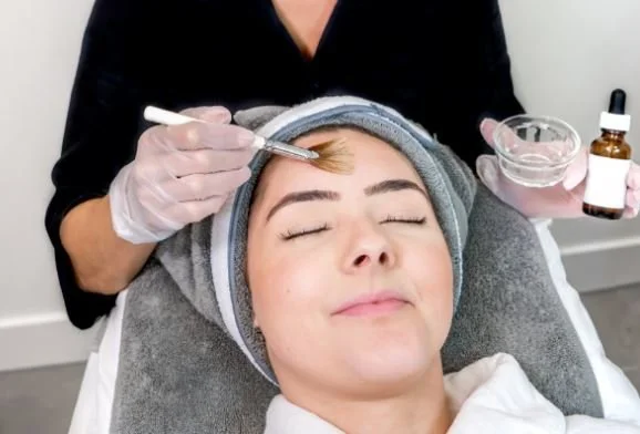 Cosmedix Chemical Peel.JPG