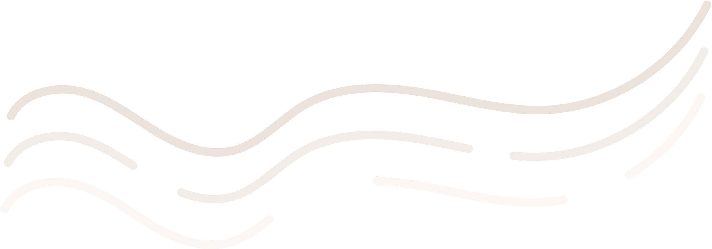 Diagram of a human foot showing the bones, muscles, and tendons in different colors.