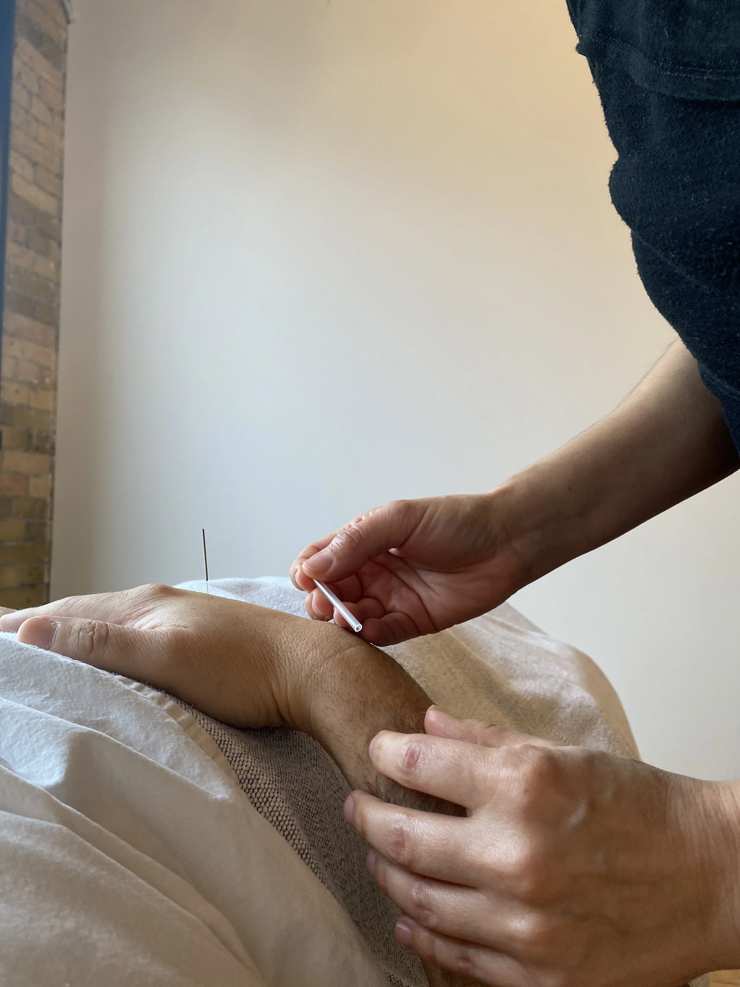 What Does Acupuncture Actually Feel Like? A First-Timer’s Guide