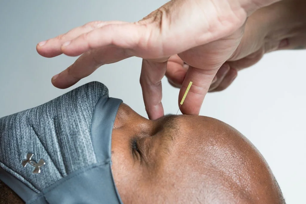 A person receiving a Botox injection in the forehead from a healthcare professional wearing gloves.