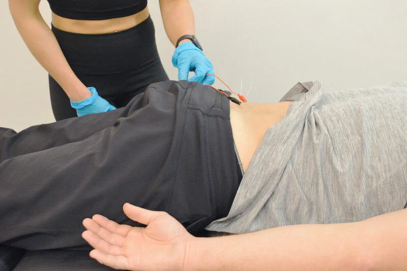 How Dry Needling in Haverhill Can Alleviate Chronic Back Pain