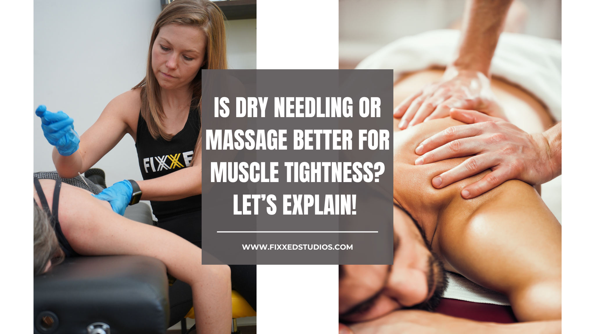 Is Dry Needling or Massage Better for Muscle Tightness? Let’s explain!&nbsp;