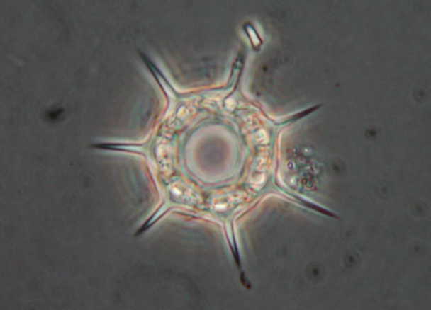 Dictyocha speculum (dinoflagellate). Cells 19-34um in diameter.