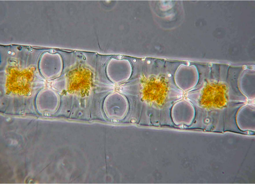 Odontella longicruris (diatom). Cells 15-110um wide.