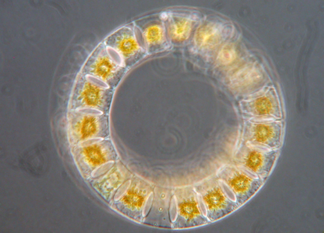 Eucampia zodiacus (diatom). Cells 10-61um wide.