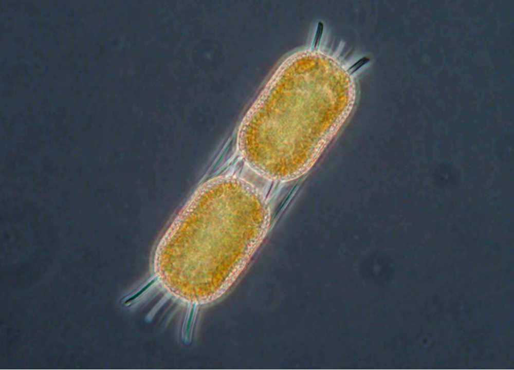 Stephanopyxis nipponica (diatom). Cells 24-36um in diameter.