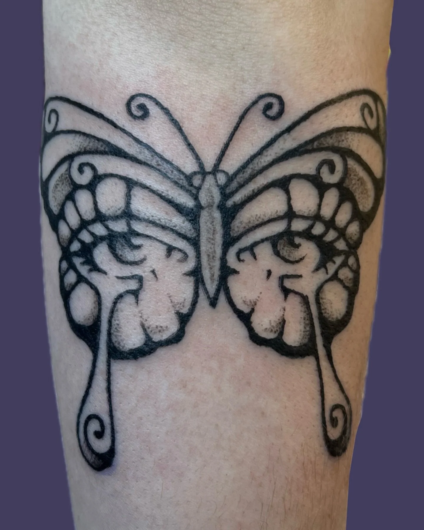 butterfly for em 🦋👁️💧 thank you always! 

Some healed photos at the end! Yippee