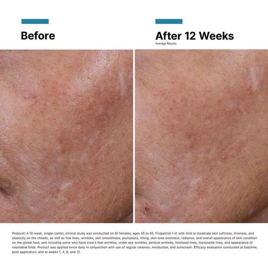 SkinCeuticals Hyaluronic Acid Intensifier Multi-Glycan_08.jpg