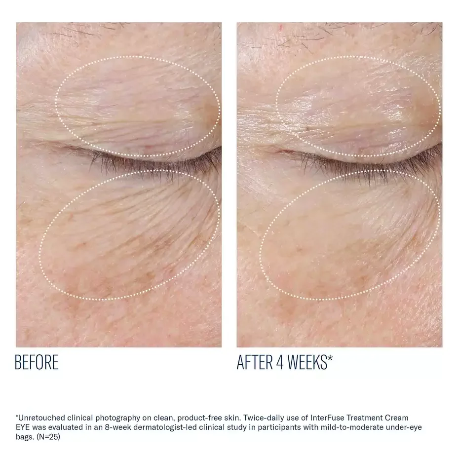 InterFuse Treatment Cream EYE_03.webp