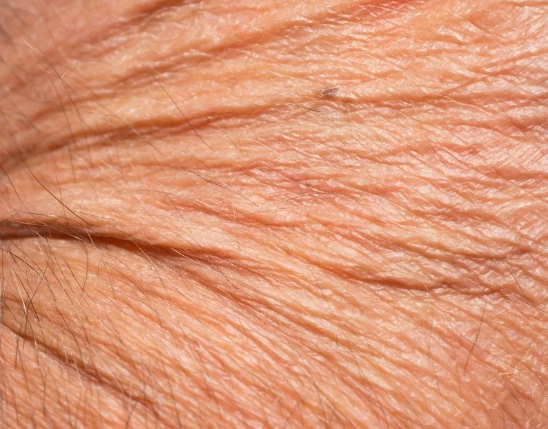 Anti-Ageing Skin Treatments at JBH Aesthetics Camden NSW