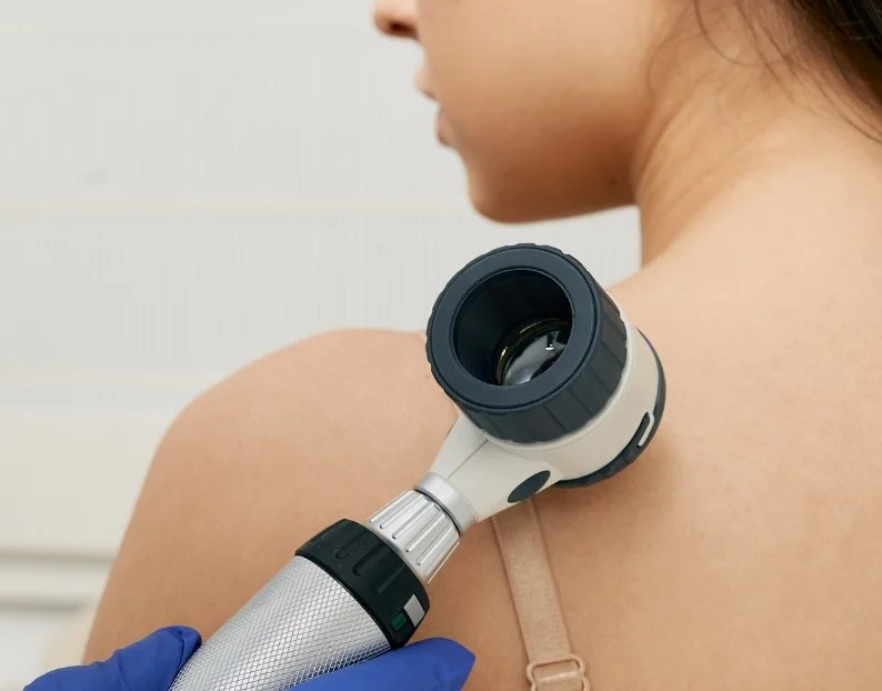 Skin Cancer Checks and Biopsies Camden NSW | JBH Aesthetics