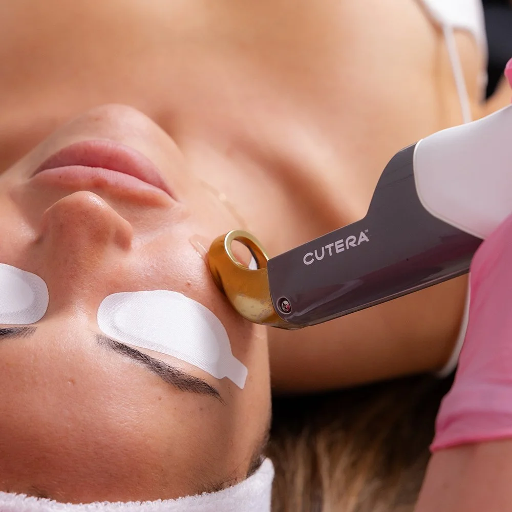 Laser Genesis Laser Therapy at JBH Aesthetics in Camden