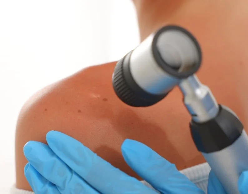 Skin Cancer Checks and Biopsies Camden NSW | JBH Aesthetics