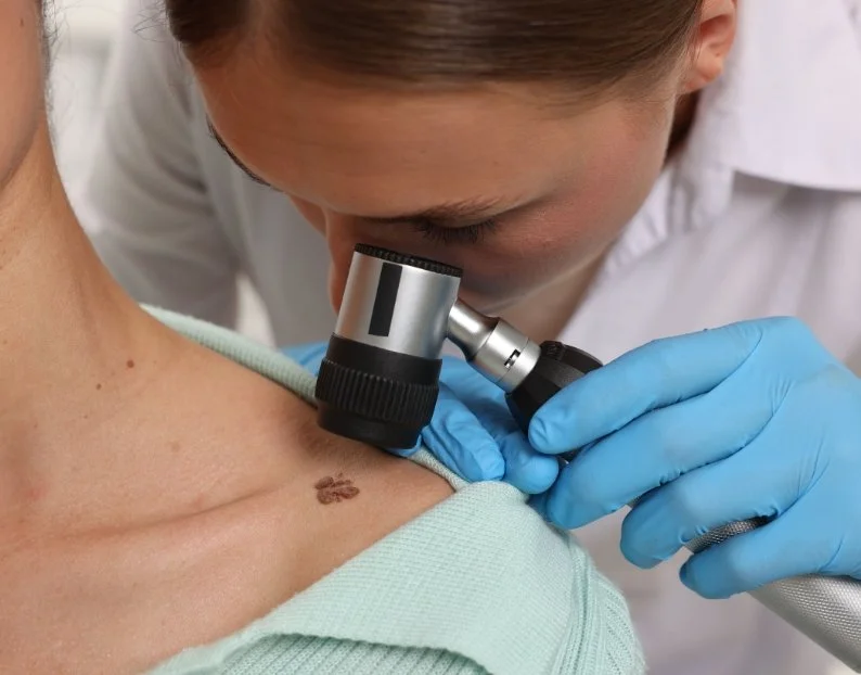 Skin Cancer Checks and Biopsies Camden NSW | JBH Aesthetics