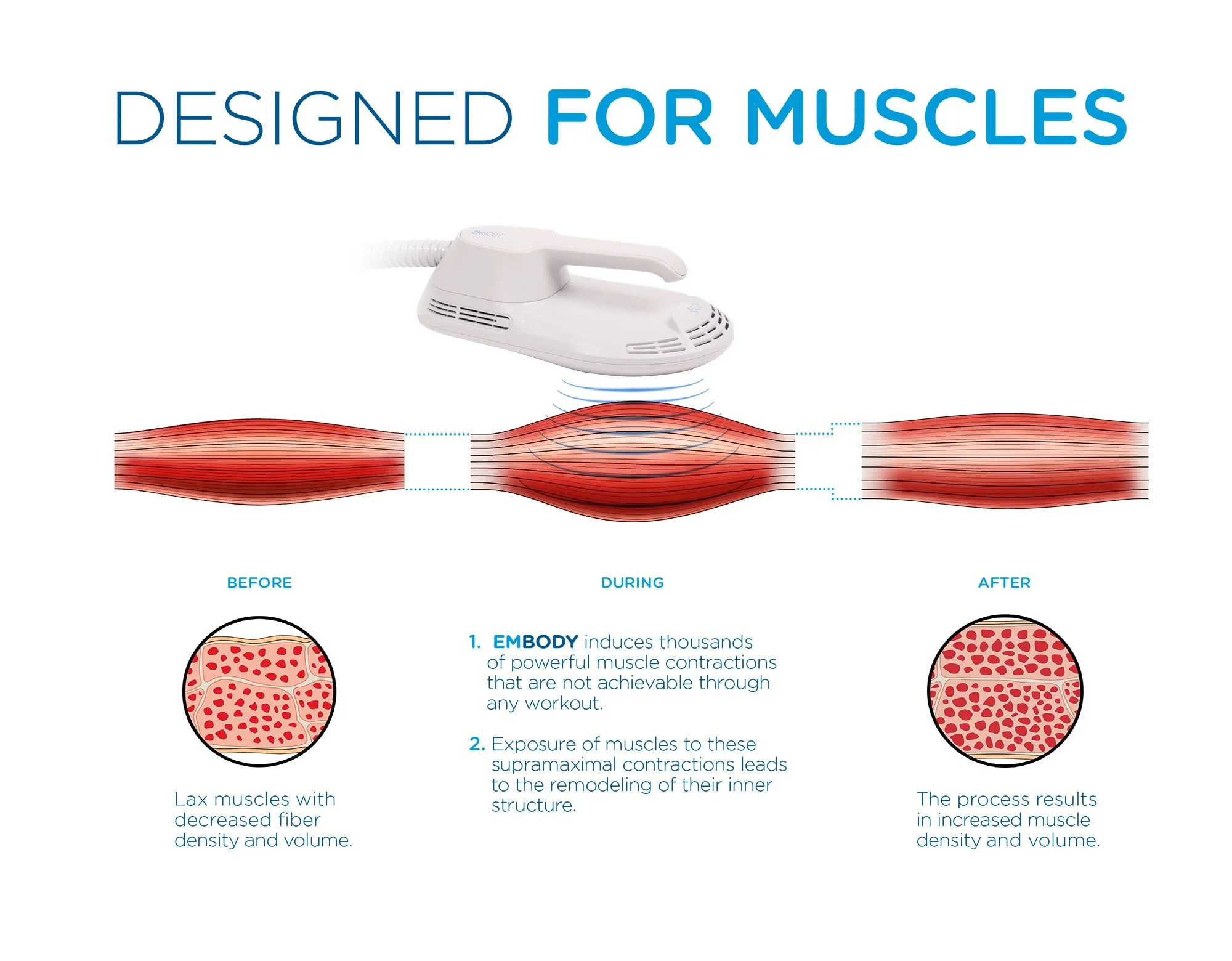 How Does EMBODY® Technology Work?