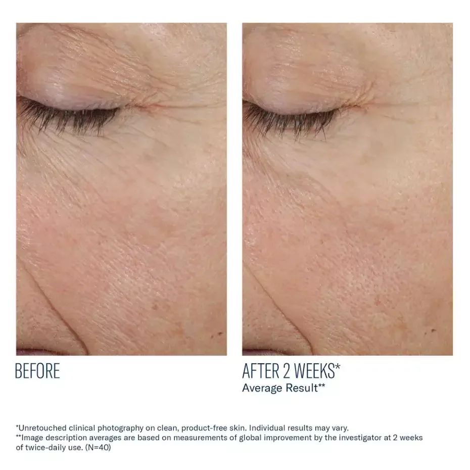 Trio Rebalancing Moisture Treatment_08.webp