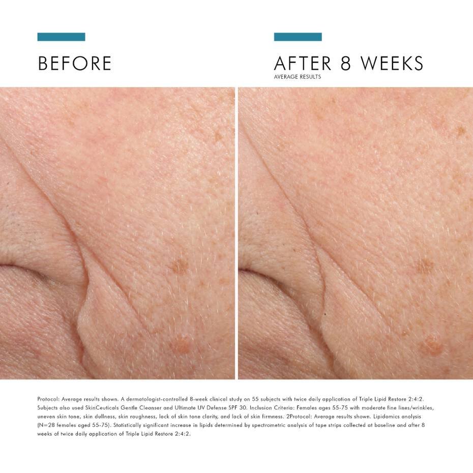 SkinCeuticals Triple Lipid Restore 242 Anti-Ageing Moisturiser_10.jpg