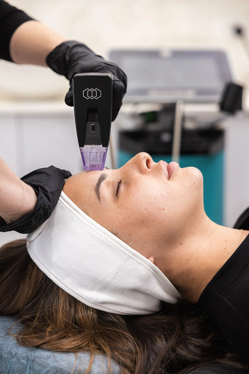 Morpheus8 RF Advanced Microneedling at JBH Aesthetics Camden NSW