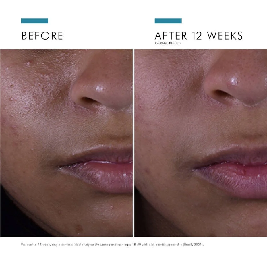 SkinCeuticals_SliymarinCF_06.jpg
