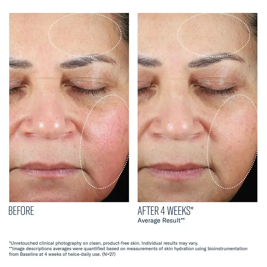 Trio Luxe Moisture Treatment_07.webp