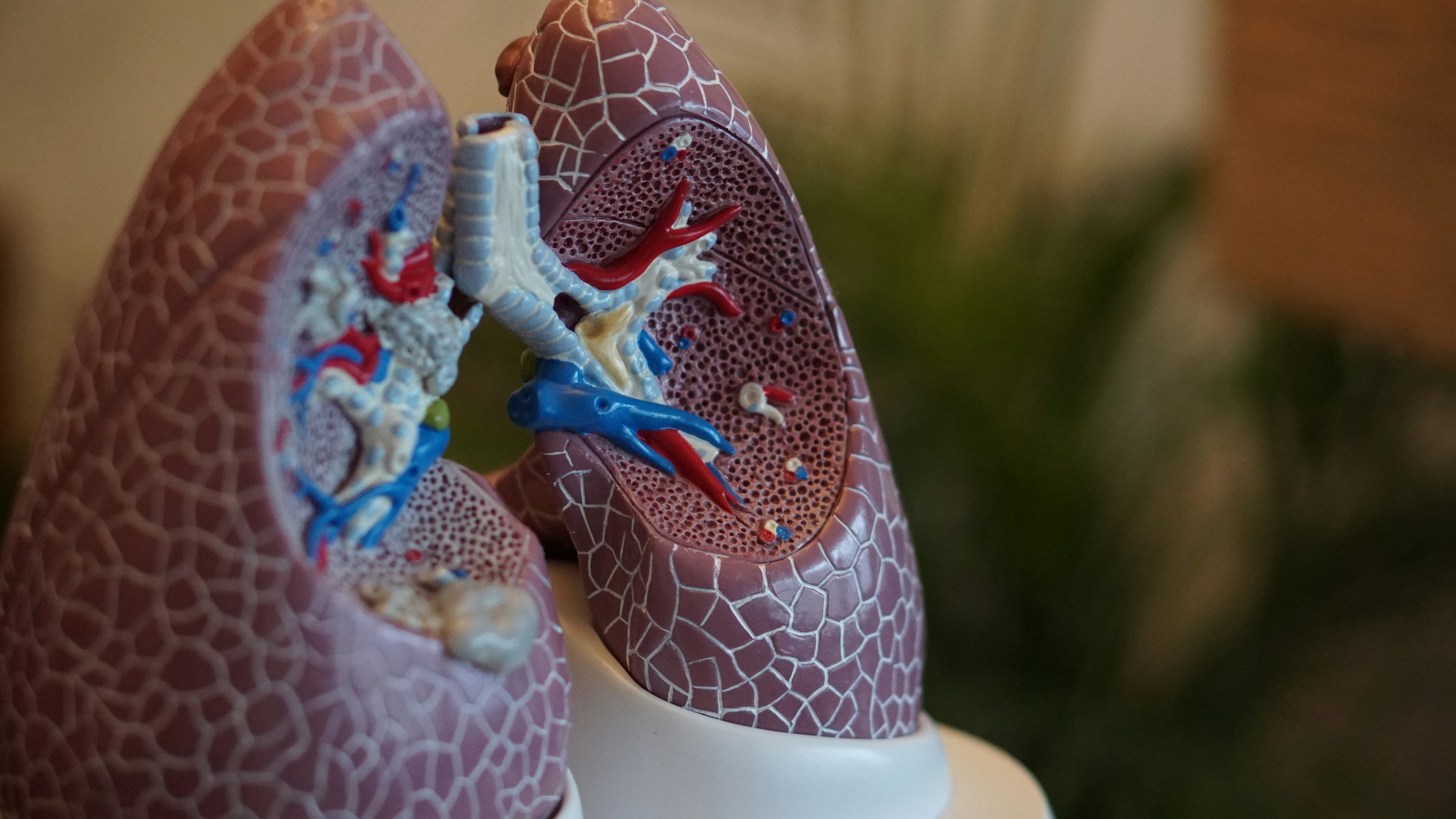 Acupuncture and Chinese Herbal Medicine for Asthma in San Luis Obispo