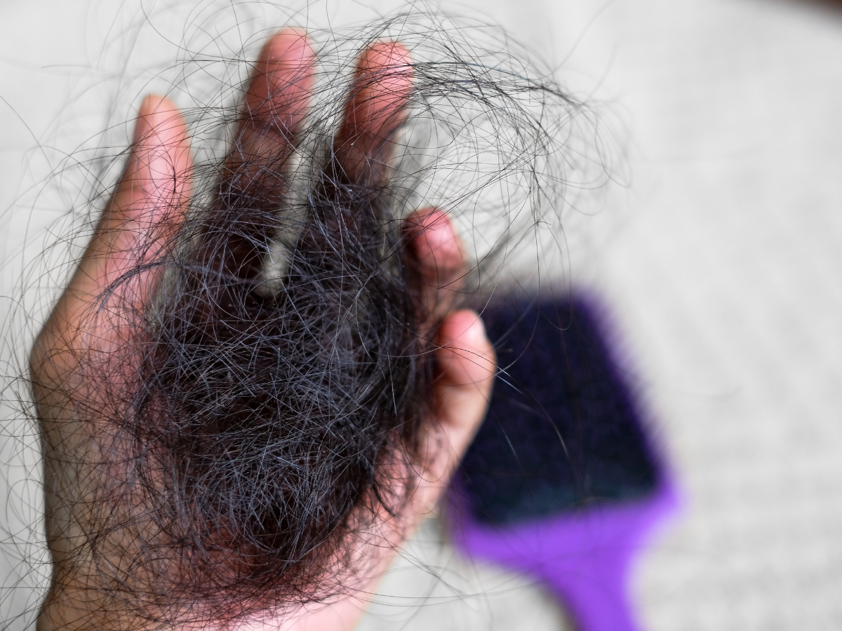 Hashimoto’s Hair Loss: Why It’s Happening and How to Stop It