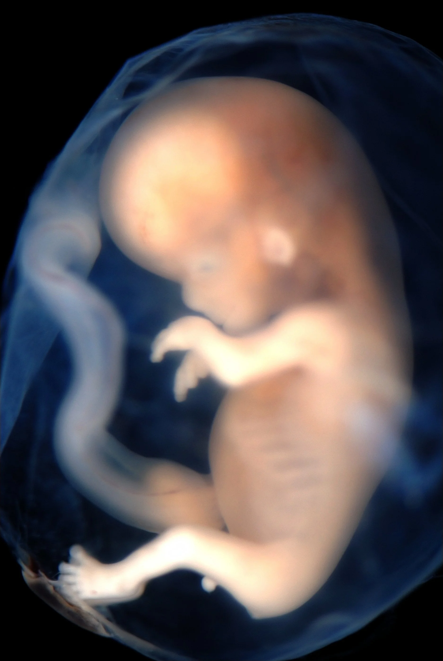 DIY Abortion: The State-Sanctioned Slaughter of 25,135 Image-Bearers