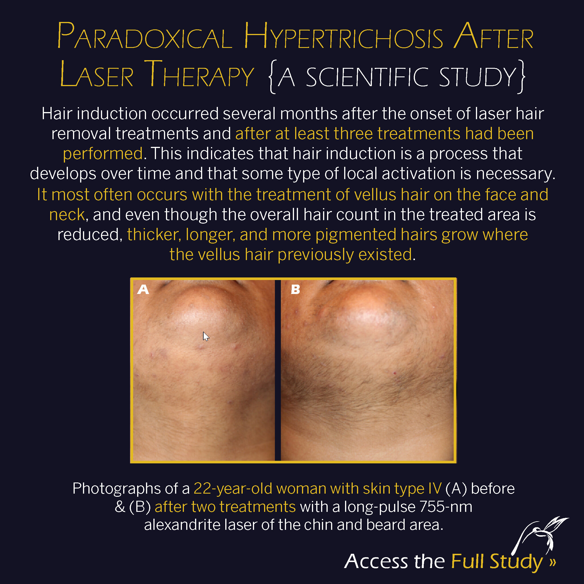 Paradoxical Hypertrichosis After Laser Therapy {A scientific study}