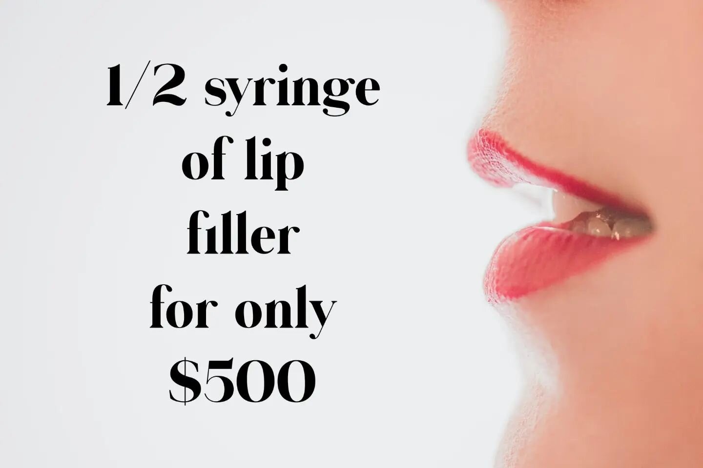 💋1/2 syringe of filler for $500. 
Not applicable with Alle points or Alle savings. Anchor members may use $50 savings included in membership. Schedule a consultation today. ☎️410-304-2051
