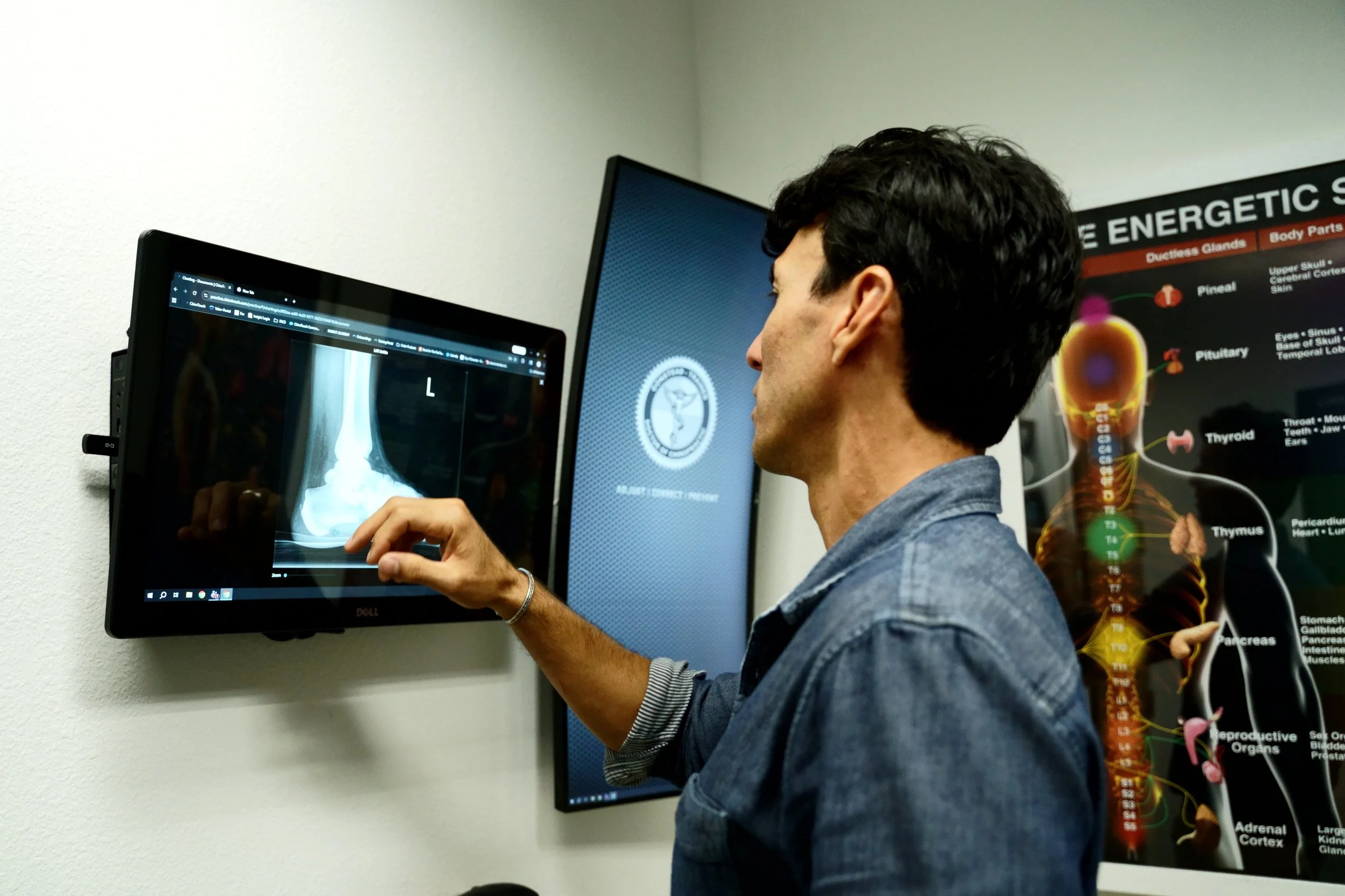 The Neurological Hierarchy: Why Extremity Adjusting is Not Optional