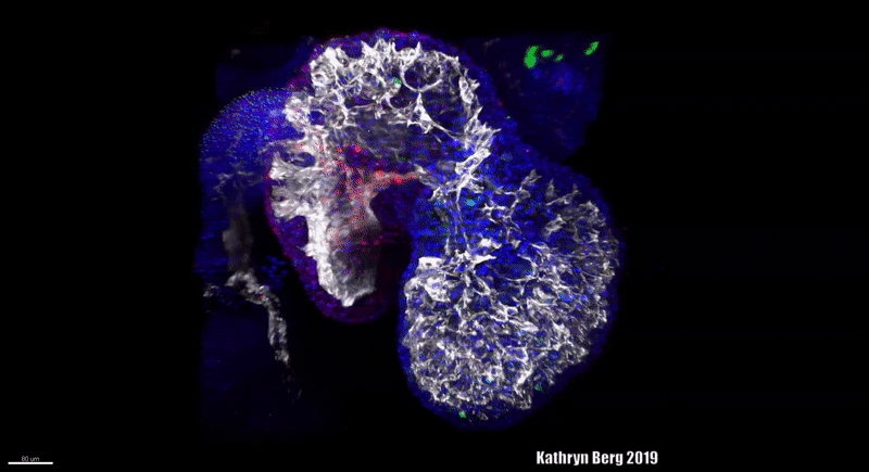 A lightsheet 3D reconstruction of an E9.5 mouse heart.