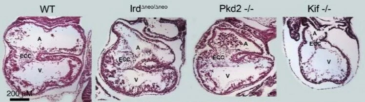 H&amp;E cross-sections of E9.5 mice of various mutant cilia and ciliary signaling backgrounds. Slough et al. (2008).
