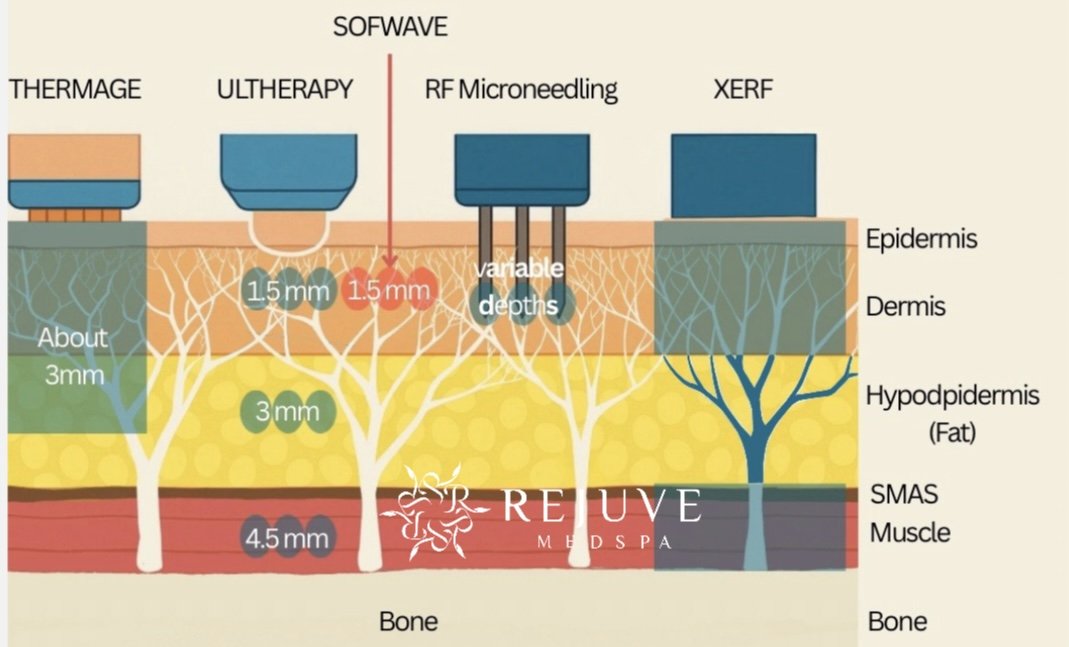 XERF Structural Skin Tightening | Rejuve Medspa